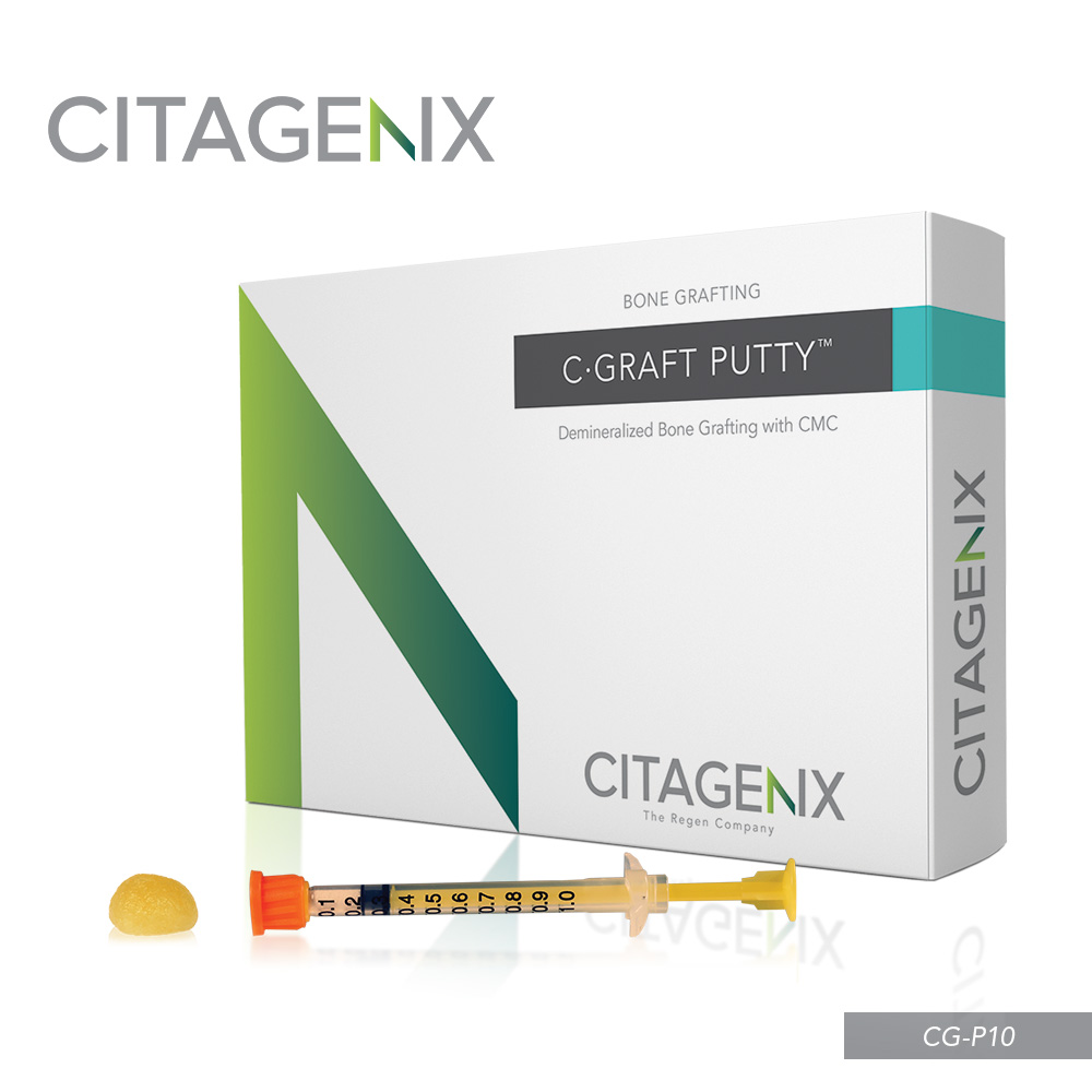 C-GRAFT PUTTY™ - SUZZOR